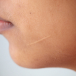 Missat försäkringsersättning vid personskada – så får du ut dina pengar!